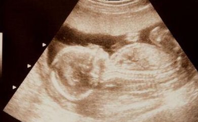 2026合肥试管婴儿机构：哪家值得信赖？